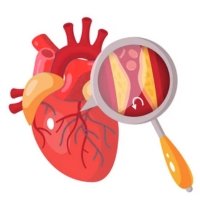 Left Main Coronary Artery Disease