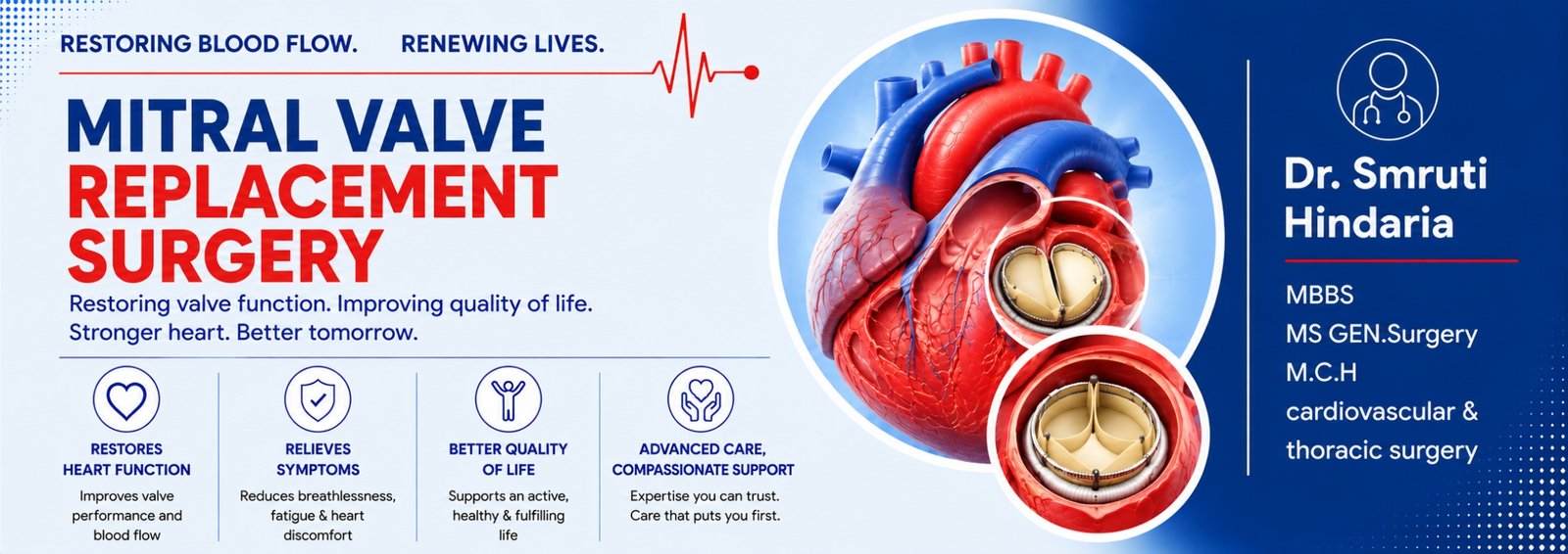 Mitral-Valve-Replacement-Surgery-in-Pune