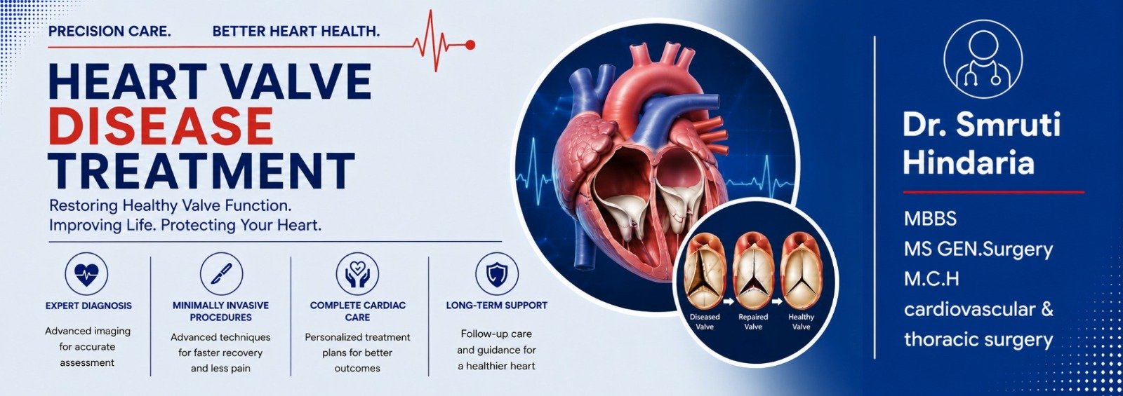 Heart Valve Disease Treatment